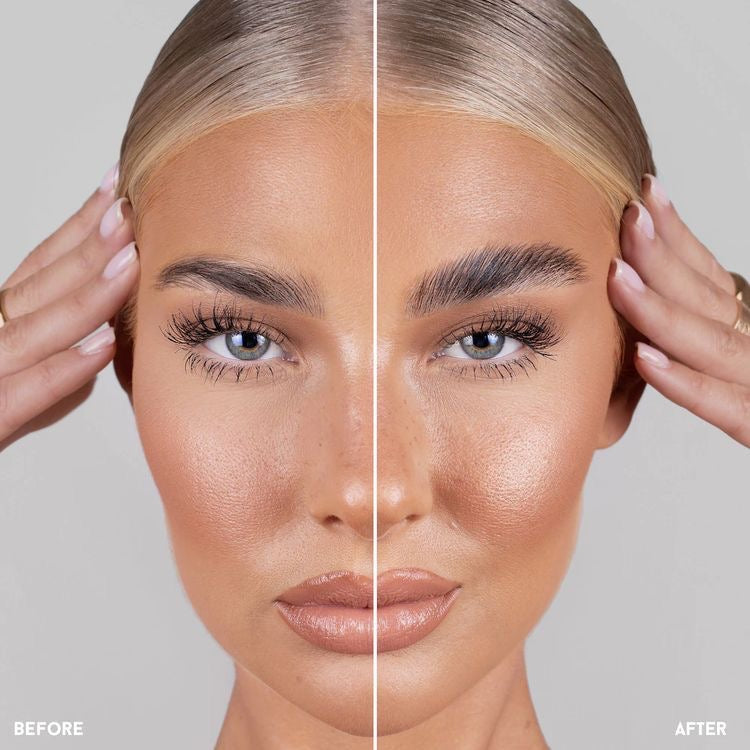 Avant apres browlift